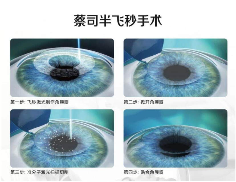 半飛秒激光