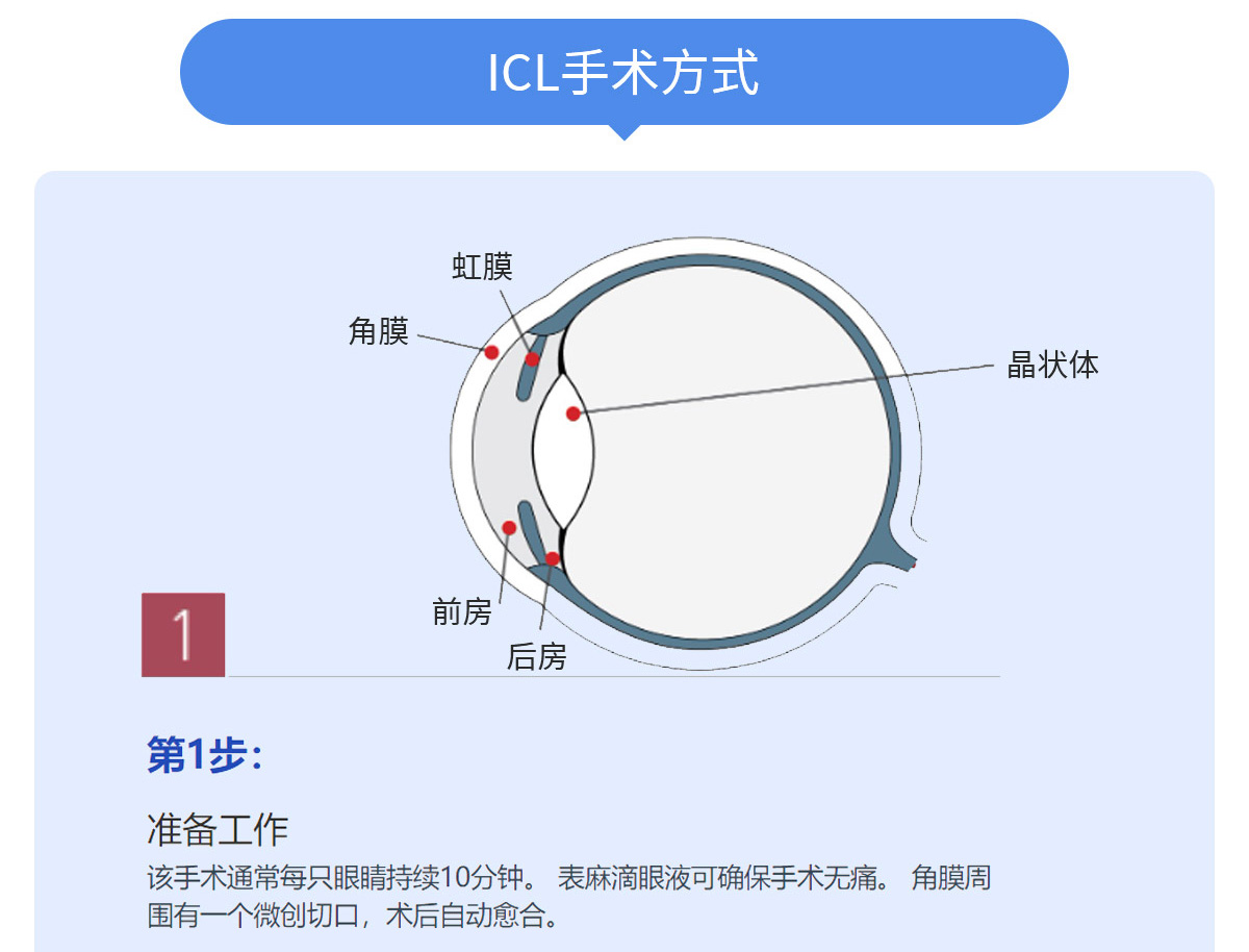 ICL_04